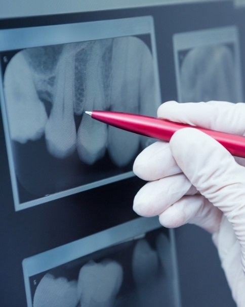 Dentist pointing to digital x rays of teeth