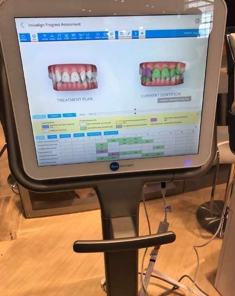 Digital models of teeth on computer monitor
