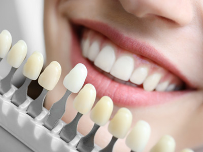 Mesquite patient smiling during whitening discussion 